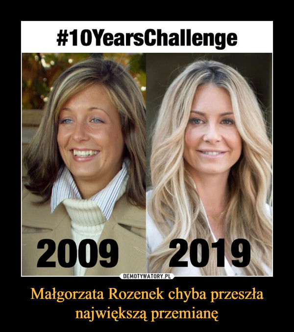 Małgorzata Rozenek chyba przeszła największą przemianę –  #10YearsChallenge